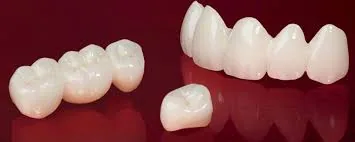 Corone e ponti in zirconio