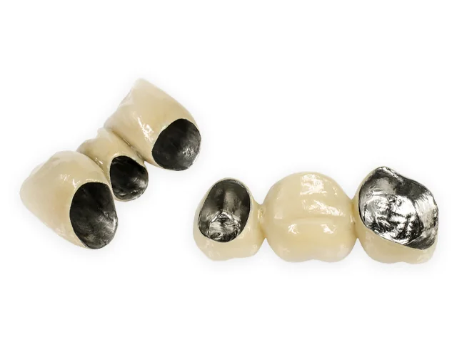 Corone in metallo-ceramica