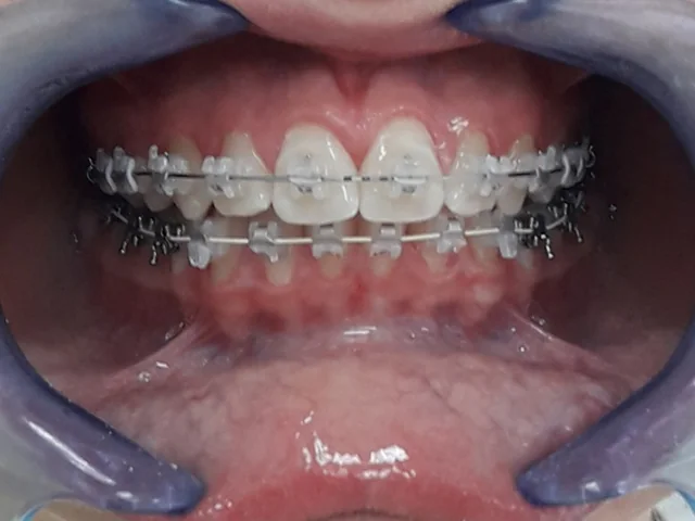 Estetici